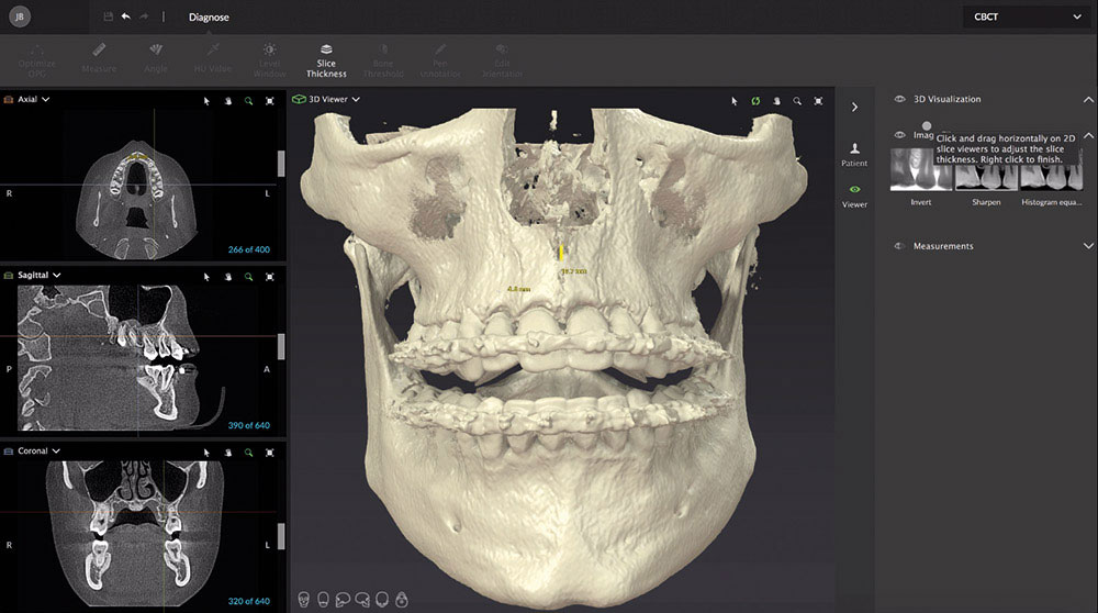顎を立体化して把握する「CT分析」